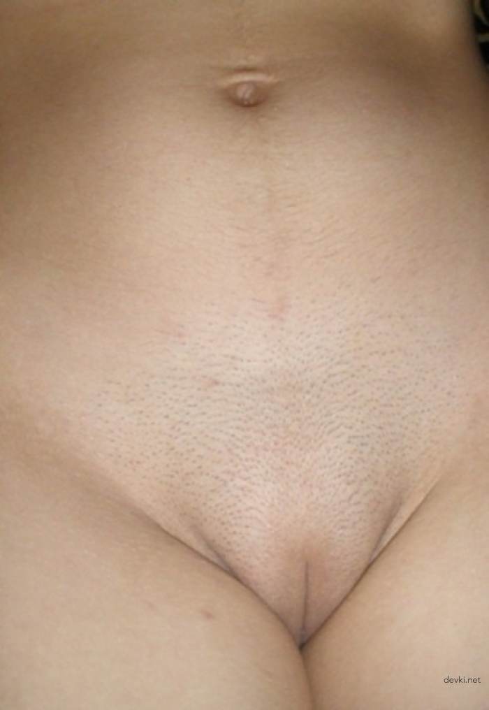 Shaved Pussy Teen Girl: Explicit Close-Up Photo