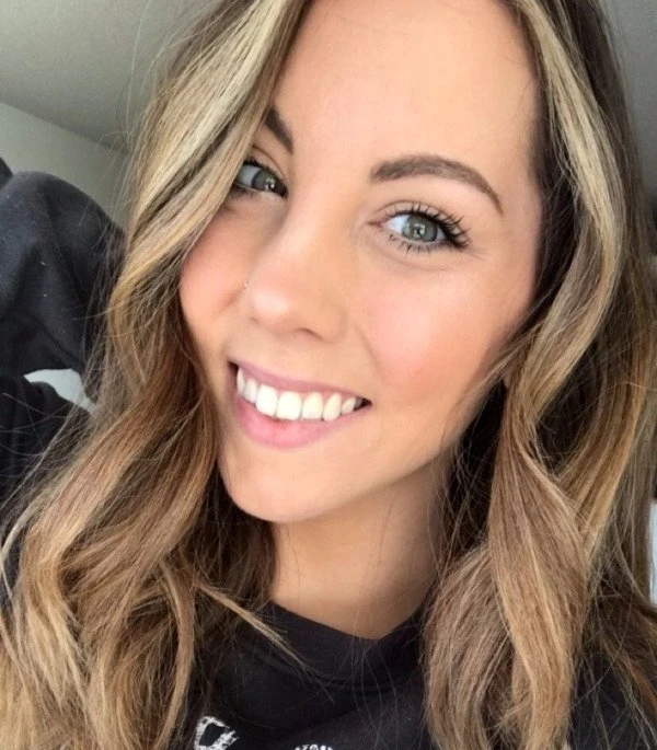 32 Stunning Smiles of Gorgeous Girls - Explicit Photos