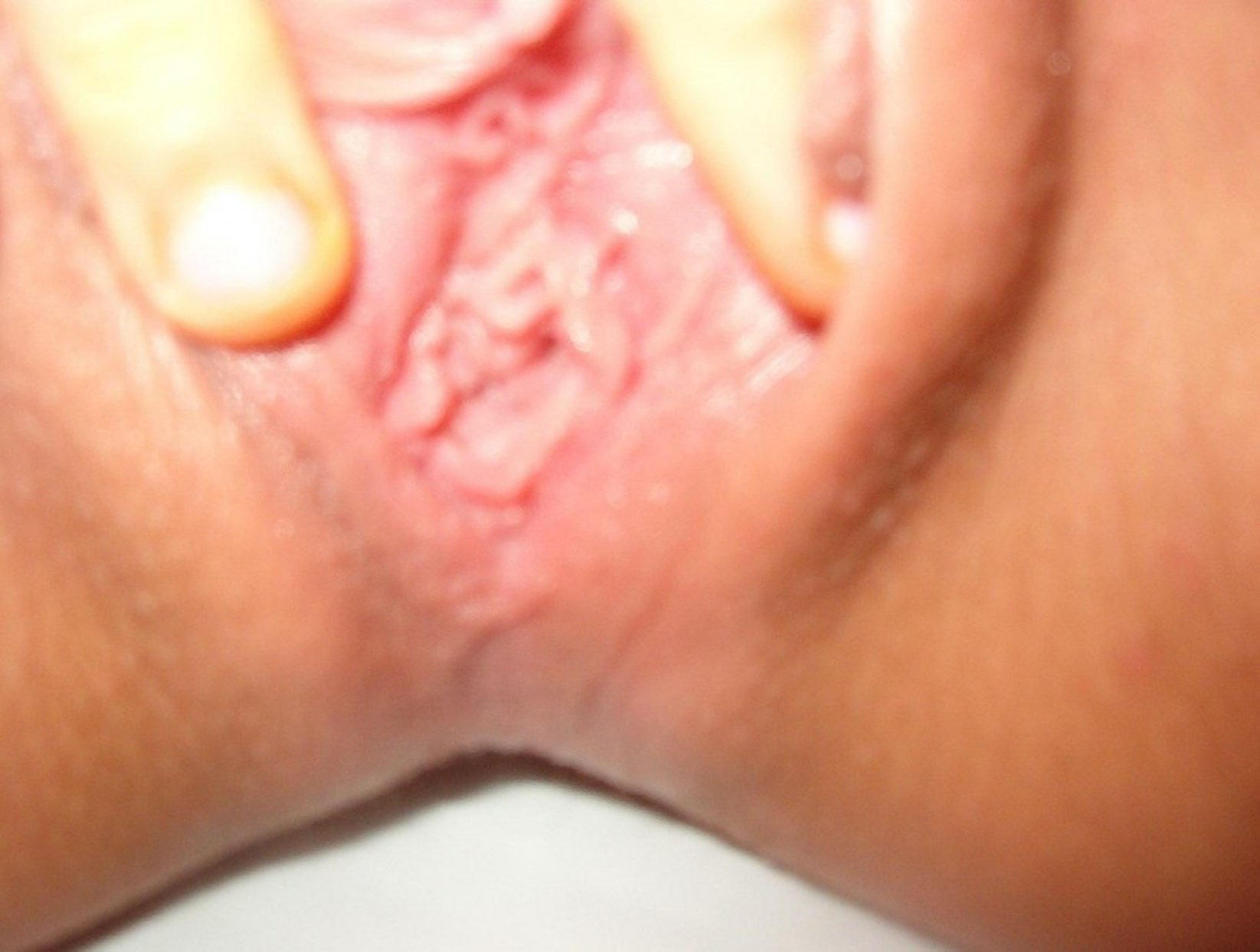 Young Girl Exposes Intimate Area in Explicit Detail and Full View for All to See