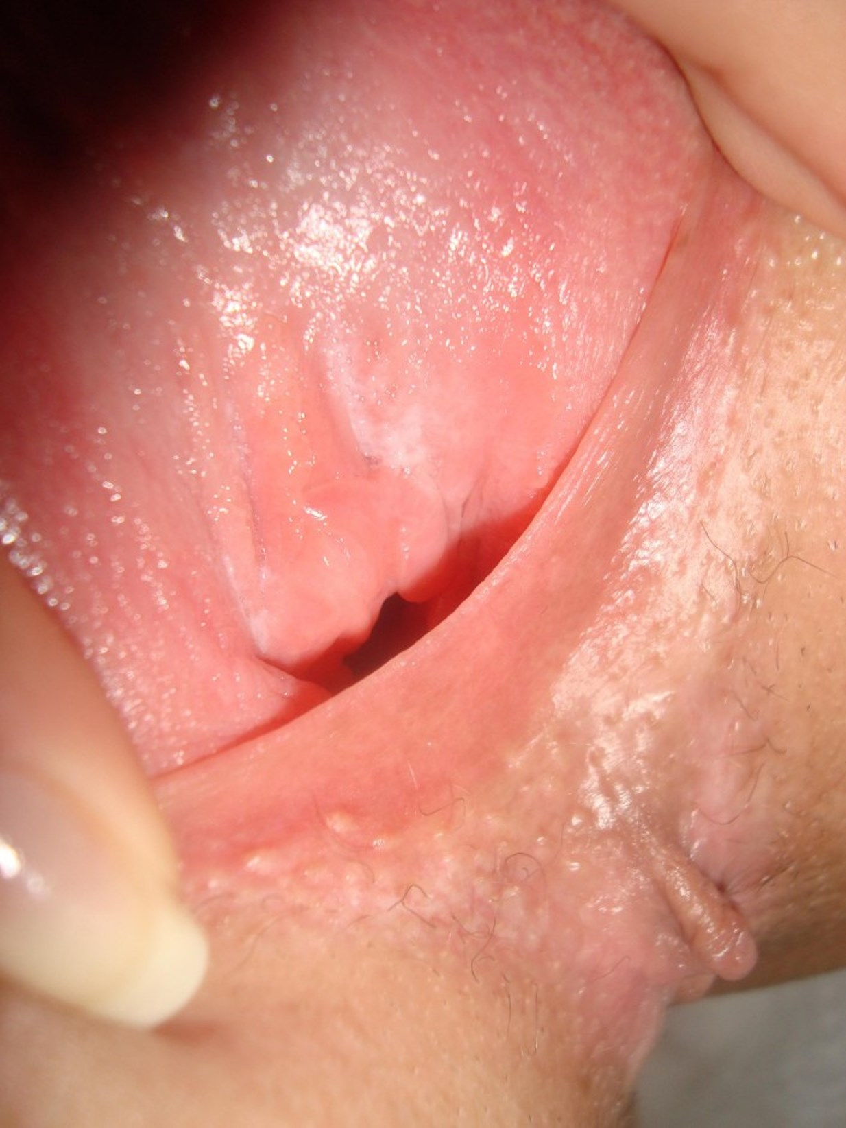 Young Girl Exposes Intimate Area in Explicit Detail and Full View for All to See